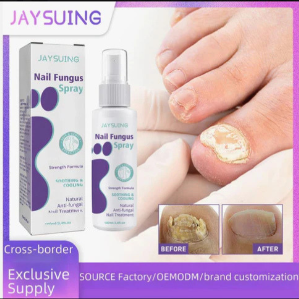 Jaysuing Nail Fungus Spray 100ml – Antifungal Nail Treatment