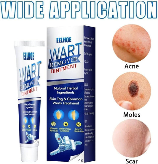 EELHOE Wart Remover Cream 20g – Wart & Skin Tag Treatment