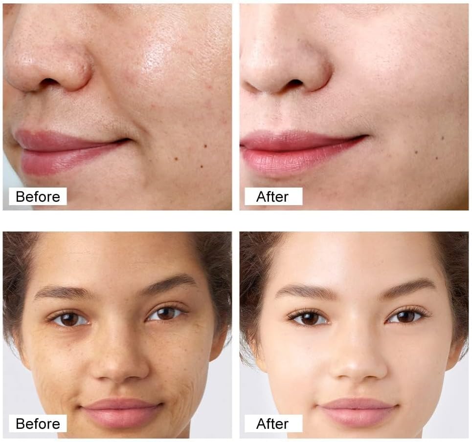 Retinol Face Cream – Anti-Wrinkle Firming & Deep Moisturizer