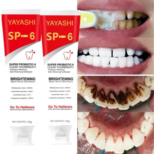 YAYASHI SP-6 Whitening Toothpaste 120g – Stain Removal & Fresh Breath