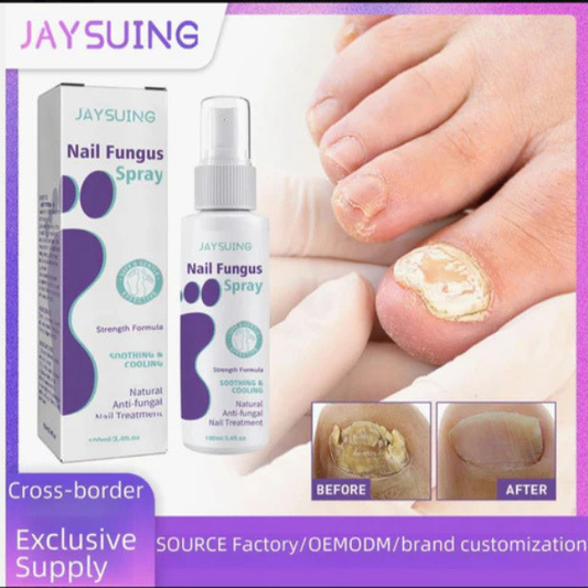Jaysuing Nail Fungus Spray 100ml – Antifungal Nail Treatment