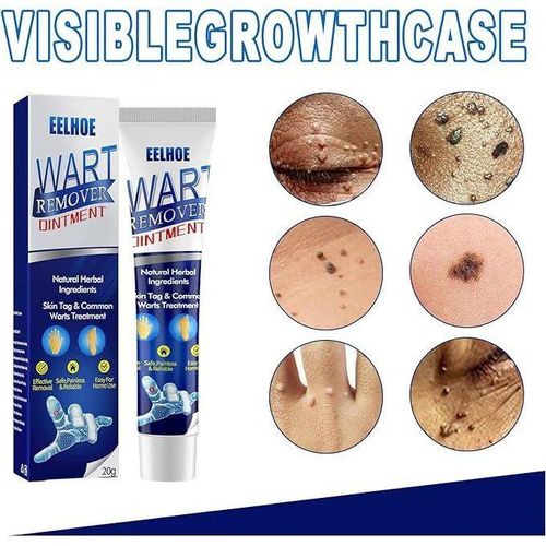 EELHOE Wart Remover Cream 20g – Wart & Skin Tag Treatment