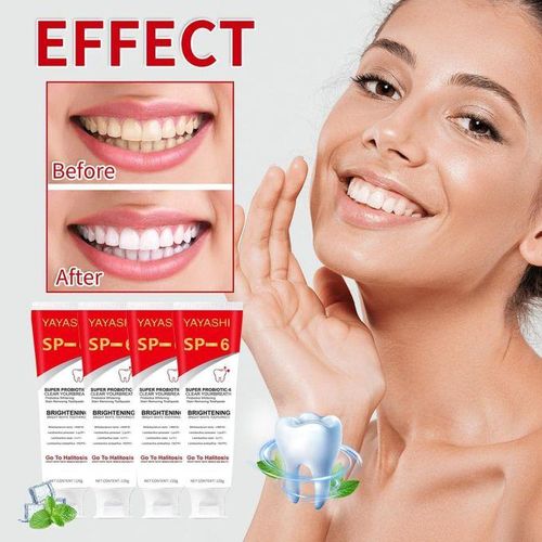 YAYASHI SP-6 Whitening Toothpaste 120g – Stain Removal & Fresh Breath