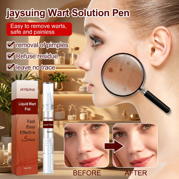 Jaysuing Liquid Wart Remover 20ml | Face, Hands & Body Care