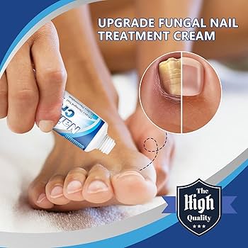 Sumifun Nail Repair Cream – Antifungal Nail Treatment & Repair Cream