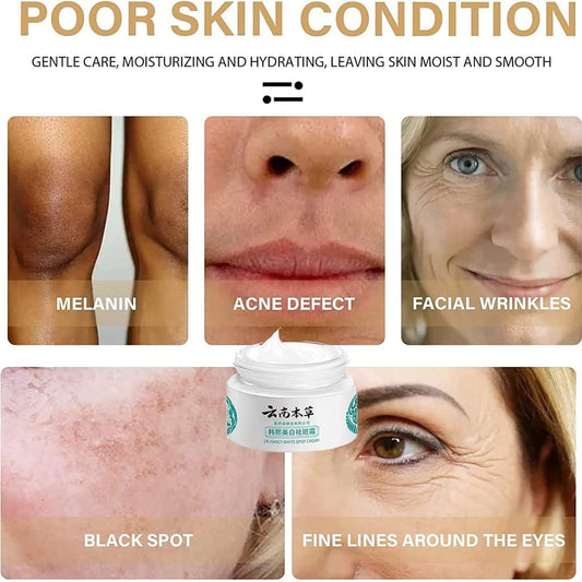 Japanese Melasma & Dark Spot Cream – Herbal Brightening Formula