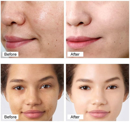Retinol Face Cream – Anti-Wrinkle Firming & Deep Moisturizer