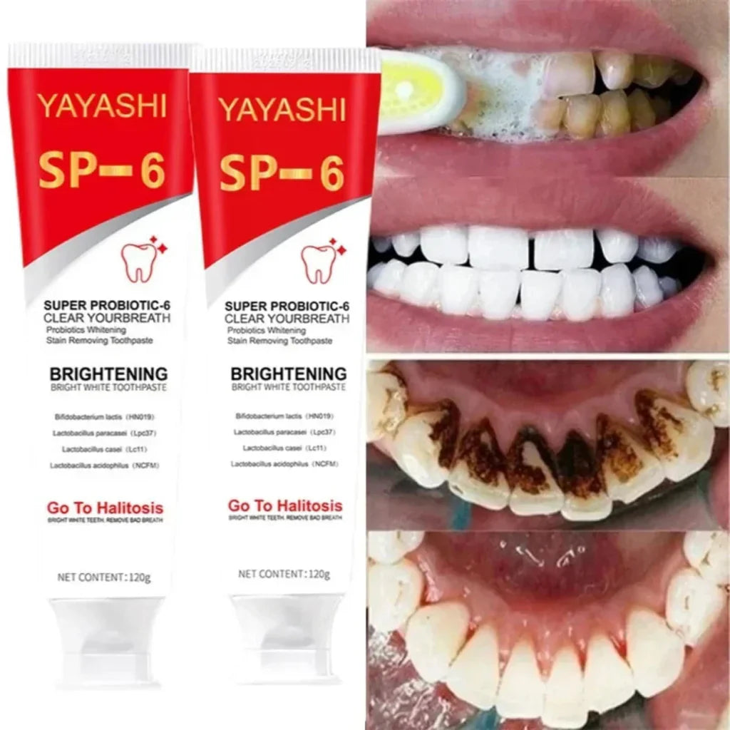 YAYASHI SP-6 Whitening Toothpaste 120g – Stain Removal & Fresh Breath