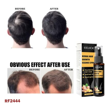 Hair Growth Essence Spray Set 30ml x2 – Anti Hair Loss Formula