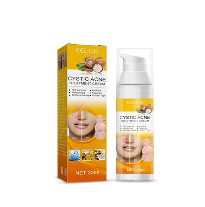 EELHOE Cystic Acne Cream 30ml – Hydrating Acne Treatment