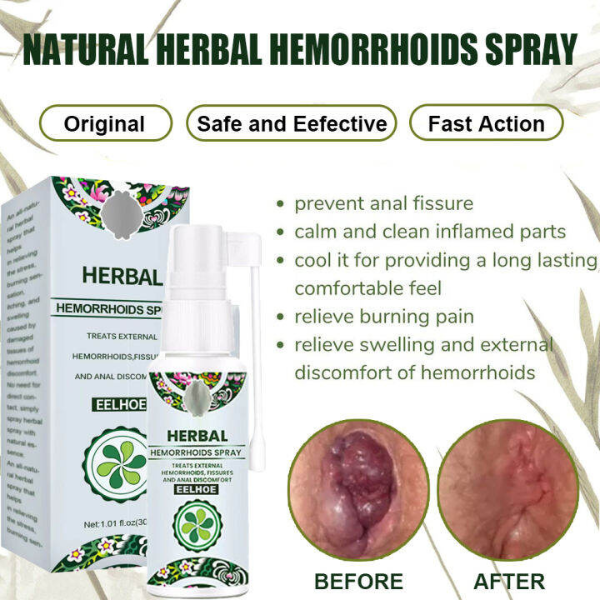Hemorrhoid Relief Spray | Fast-Acting & Mess-Free - Image 6
